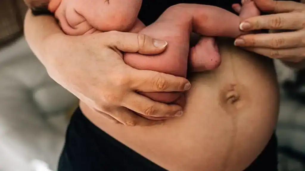 Why Is My Stomach Still Big After Pregnancy Langley?